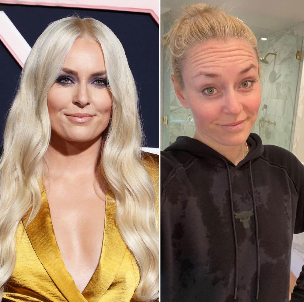 Lindsey Vonn Gets Candid About ‘True Beauty’: Pics