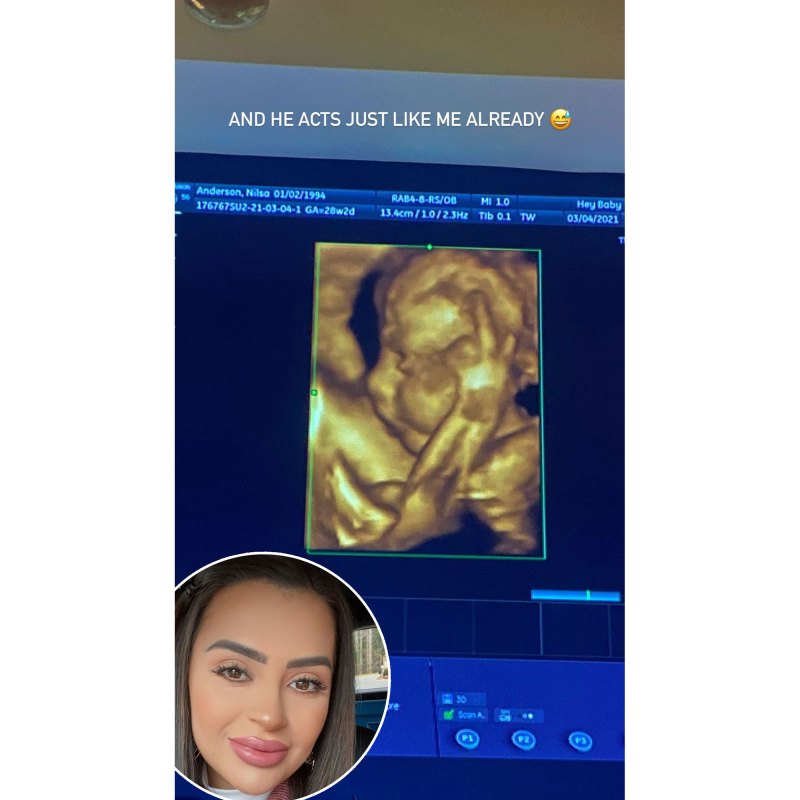 Nilsa Prowant Shares Sonogram of Baby Flipping Off the Camera
