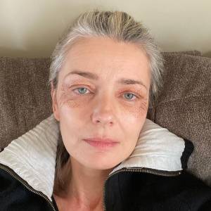 Paulina Porizkova, 55, Shows Off Puncture Marks from Anti-Aging Treatment: “I’m Vain and Want to Be Pretty’