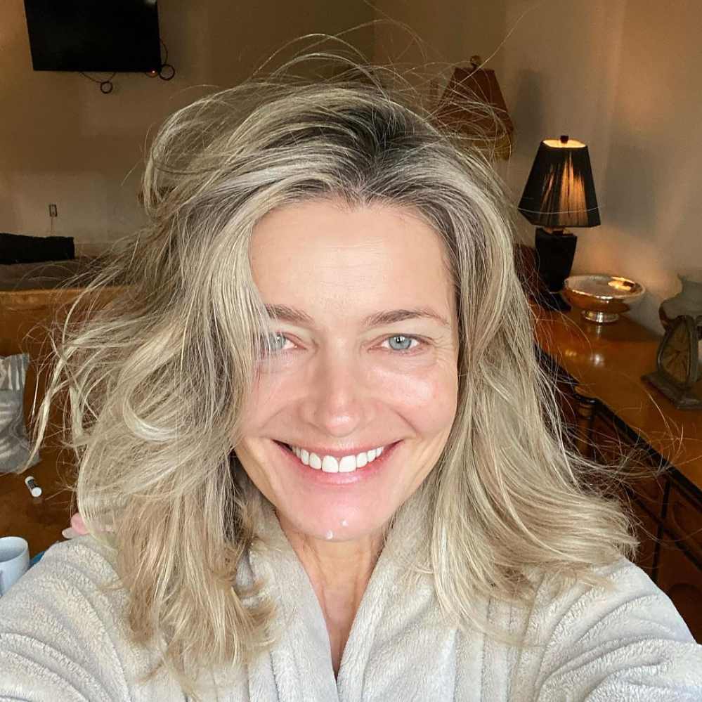 Paulina Porizkova, 55, Shows Off Puncture Marks from Anti-Aging Treatment: “I’m Vain and Want to Be Pretty’