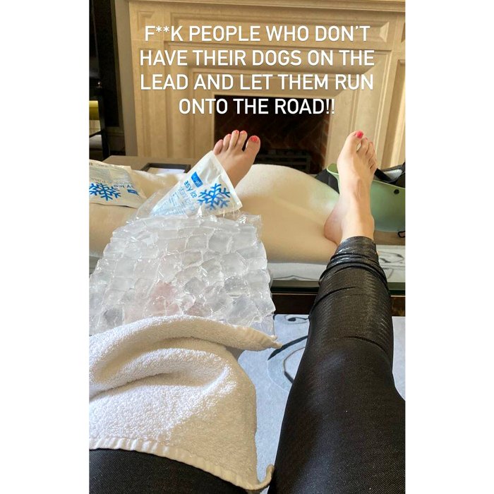 Rebel Wilson se lesiona la pierna después de un incidente con un perro desatado