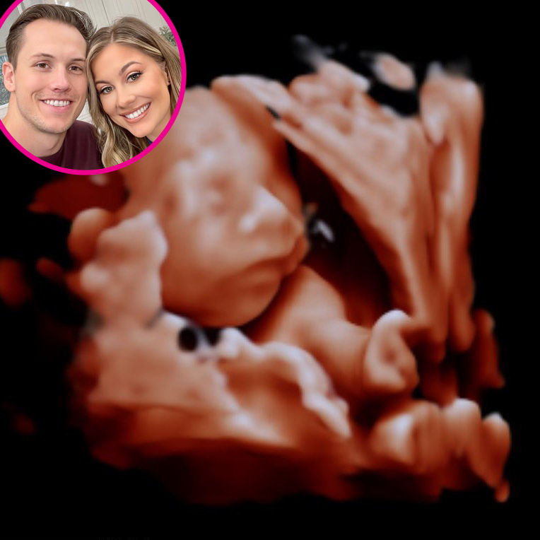 Shawn Johnson and More Pregnant Stars Share Ultrasound Pics