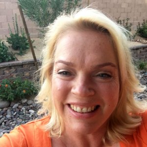 Sister Wives’ Janelle Brown Reveals Skin Cancer Diagnosis
