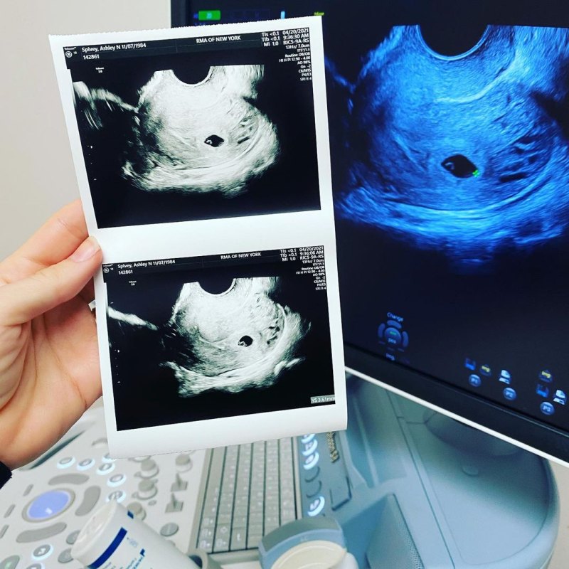 Bachelor’s Ashley Spivey and More Pregnant Stars Share Ultrasound Pics