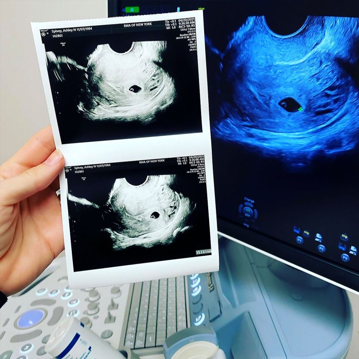 Bachelor Nations Ashley Spivey embarazada después de sufrir un aborto espontáneo 2020