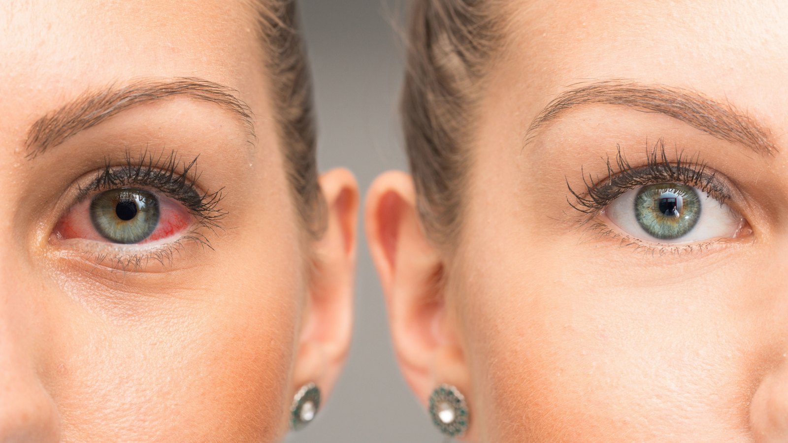 Before-After-Dry-Tired-Eyes-Stock-Photo