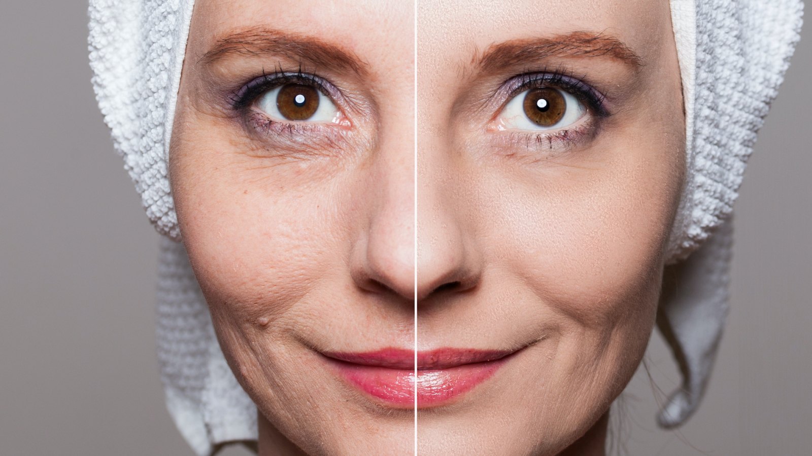 Before-After-Wrinkles-Stock-Photo
