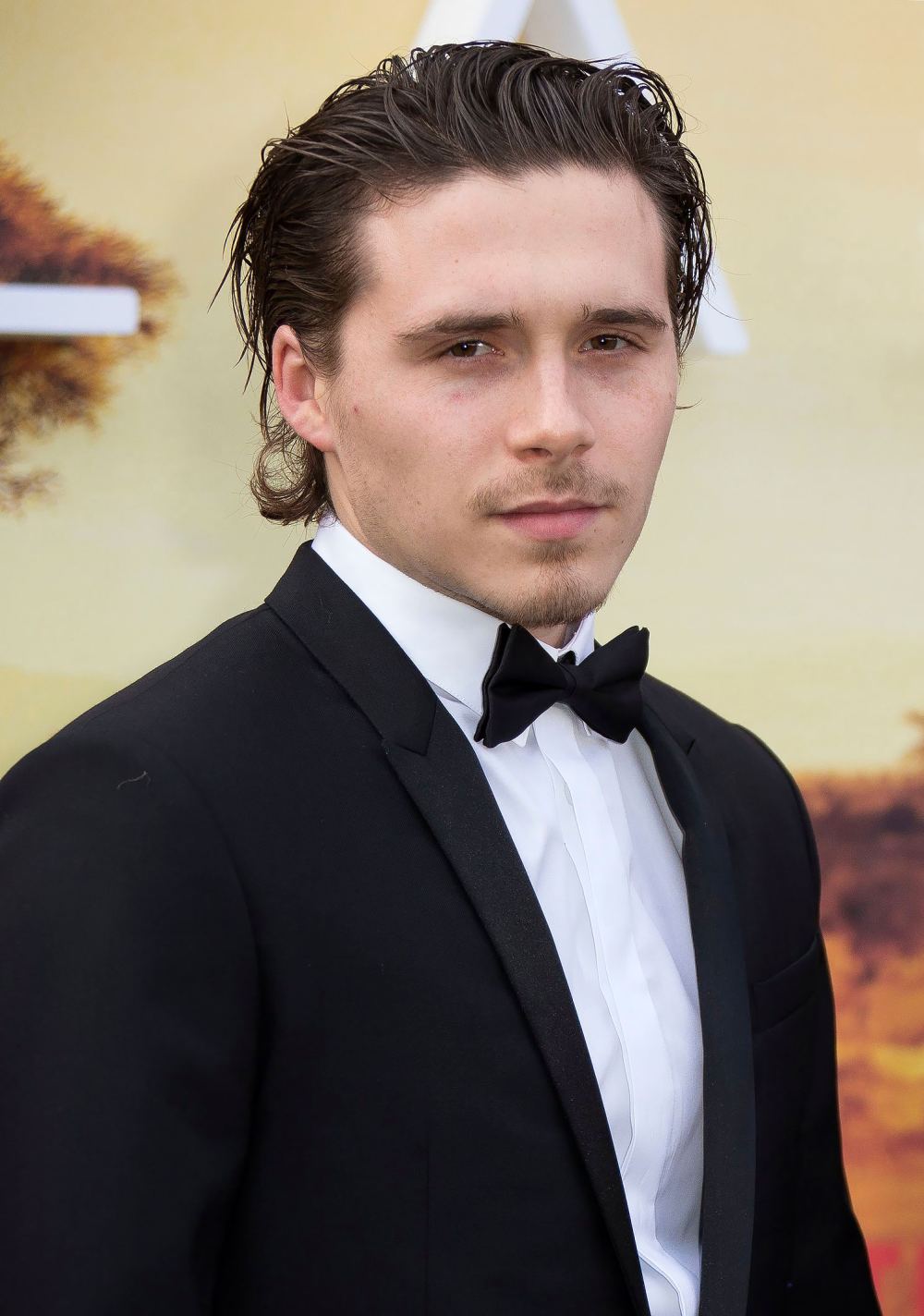 Everything We Know About Brooklyn Beckham&rsquo;s Body Bruising Treatment