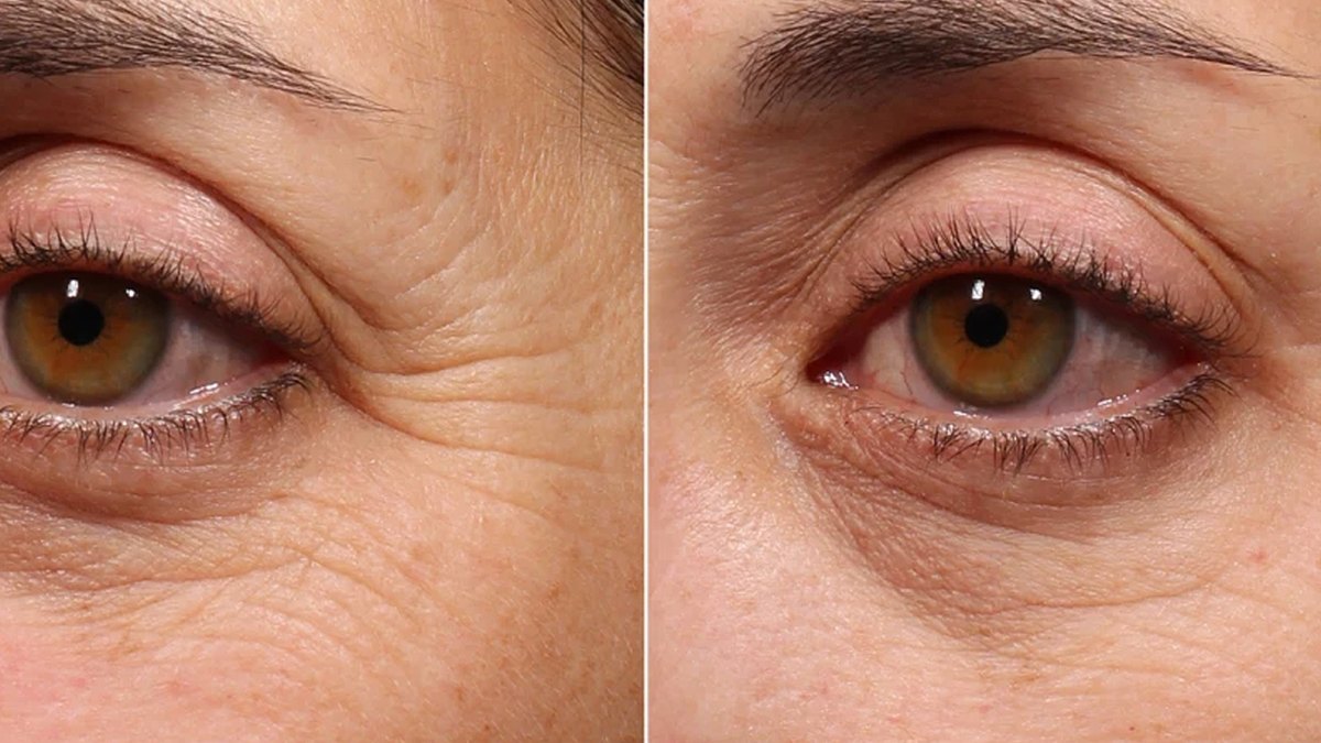 murad-retinol-eye-youth-serum