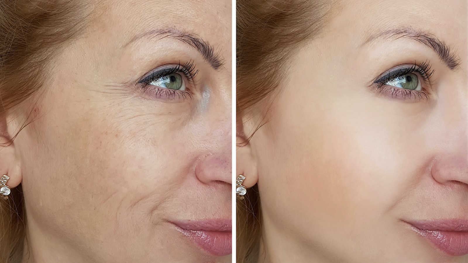 Before-After-Brighter-Skin-Stock-Photo
