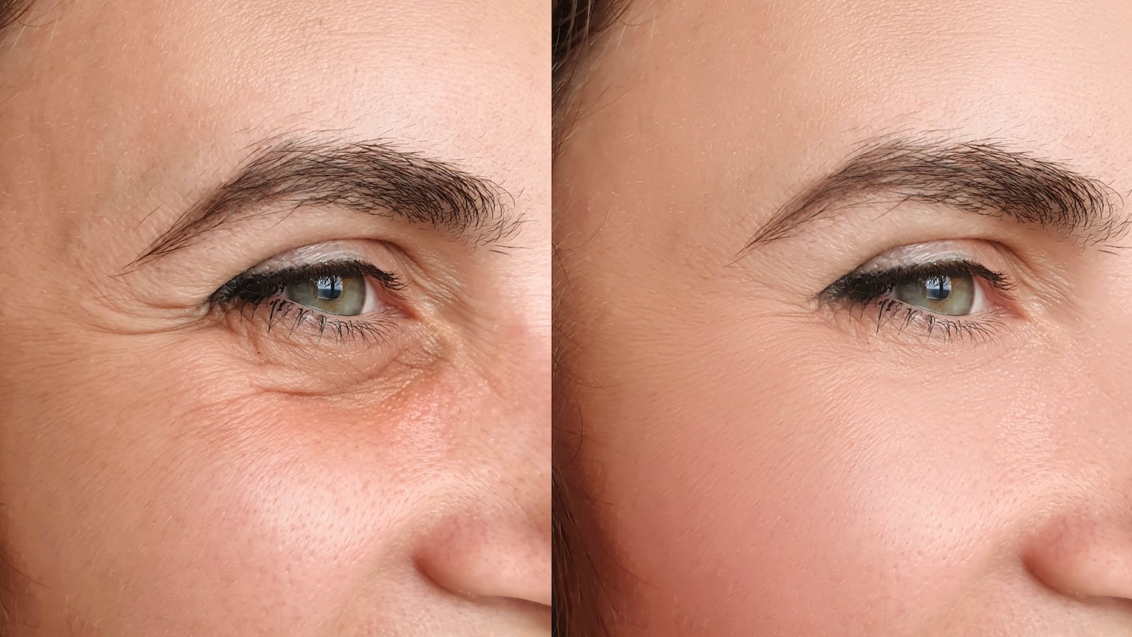Before-After-Skin-Primer-Stock-Photo