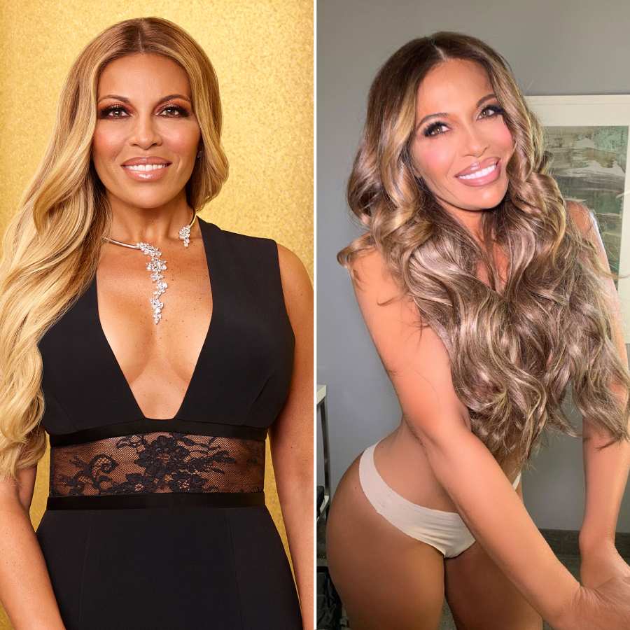 Dolores Catania Celebs Who Admitted They Got Plastic Surgery