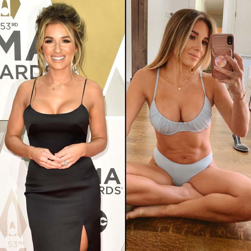 Jessie James Decker Celebs Who Admitted They Got Plastic Surgery