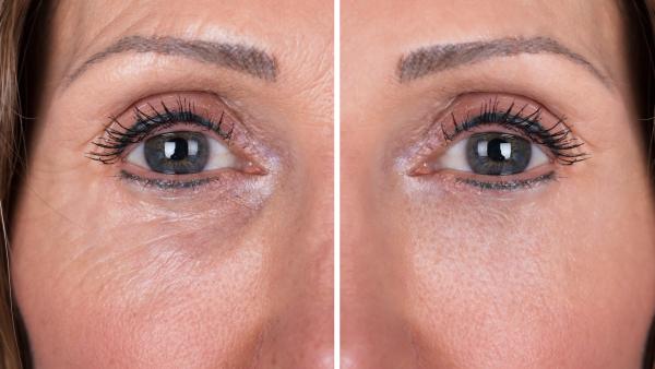 Anti-Aging-Treatment-Stock-Photo