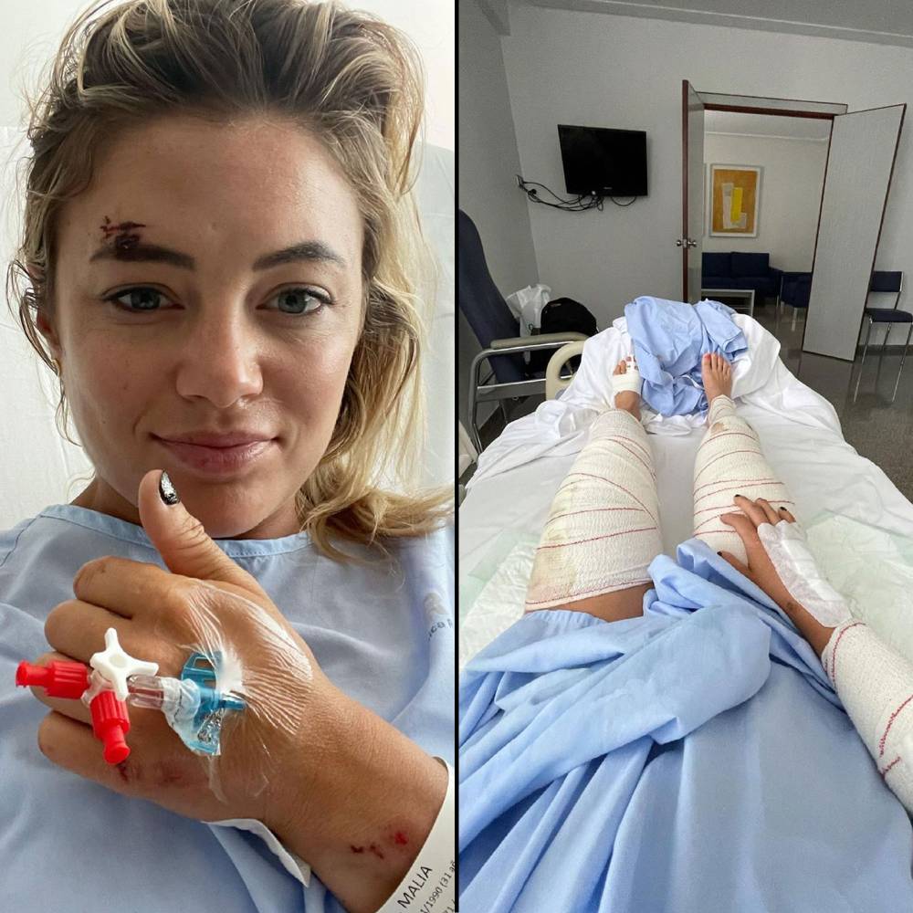Below Deck Mediterranean Malia White Hospitalized in Spain Following Scooter Accident 5