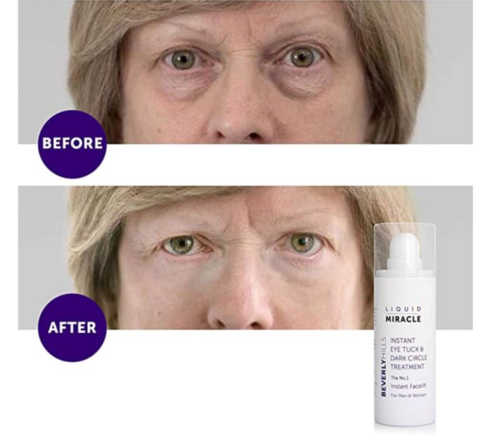 Beverly Hills Liquid Miracle Instant Facelift and Eye Serum Treatment