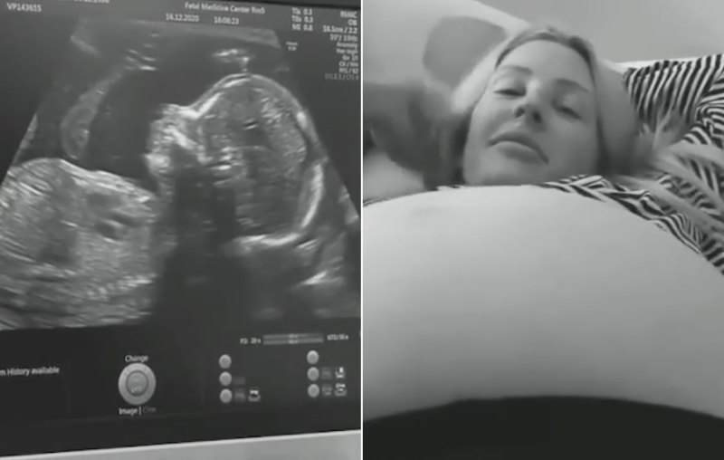 Pregnant Stars Share Ultrasound Pics
