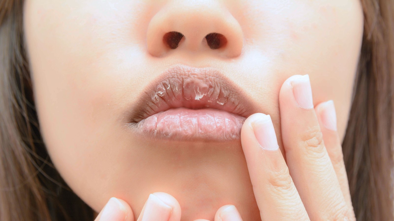 Chapped-Lips-Stock-Photo