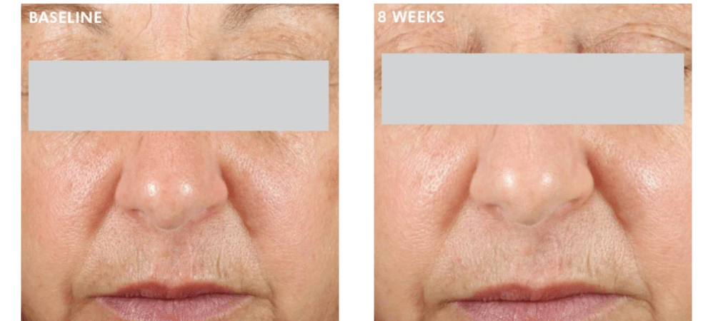 Daily Brightening UV Defense Sunscreen SPF 30