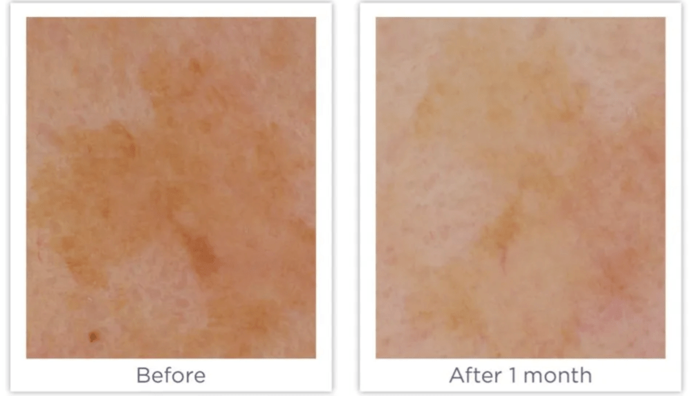 Enhance Brightening Serum