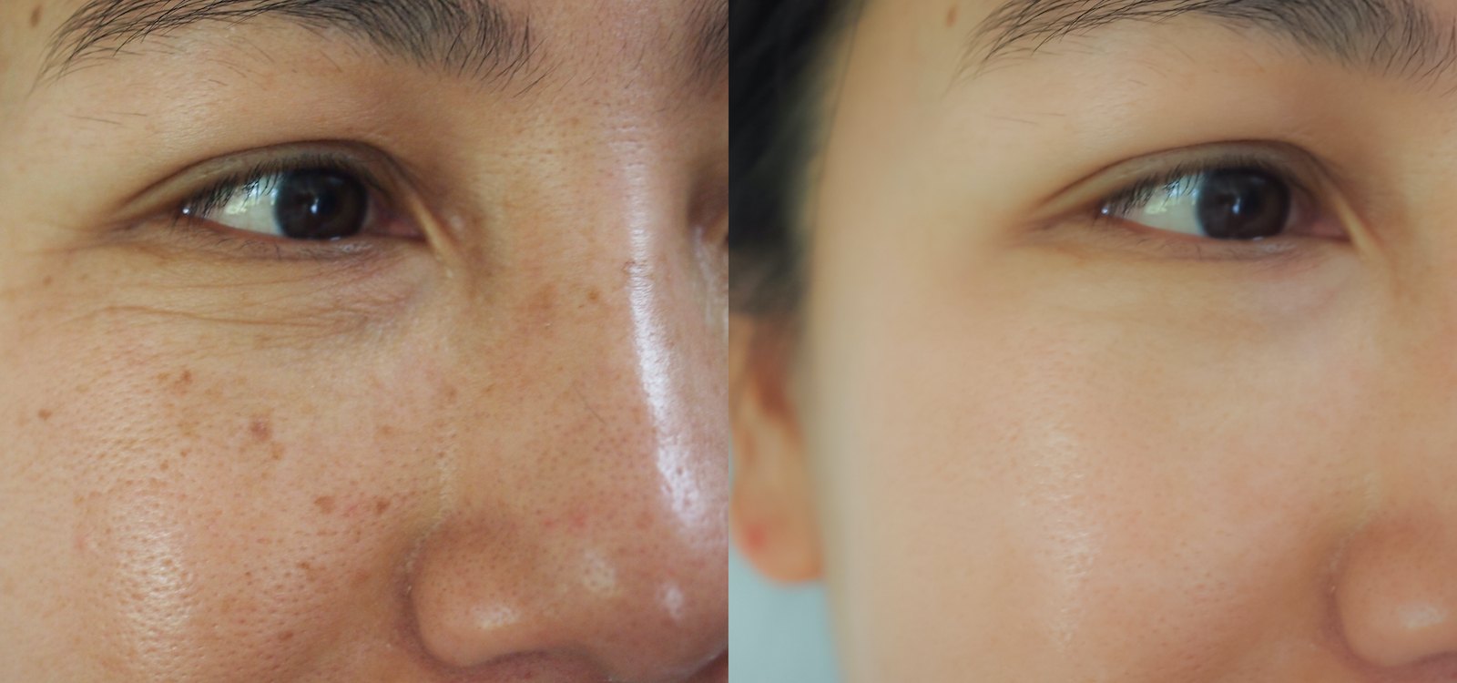 Sun-Spots-Before-After