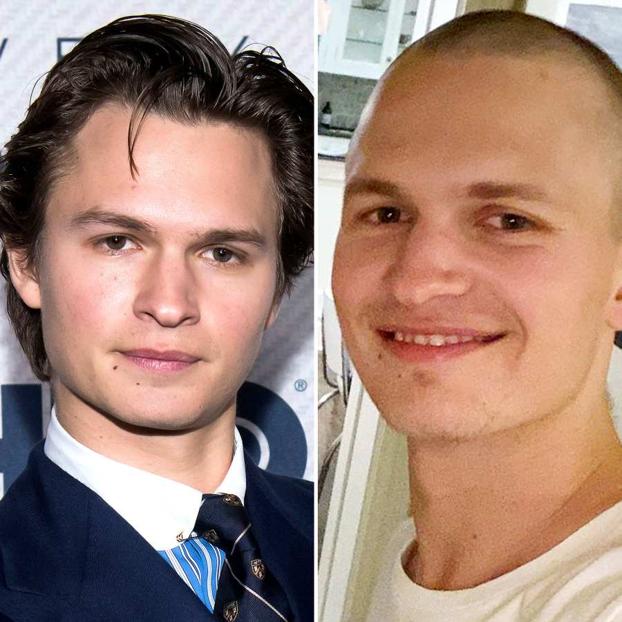 Ansel Elgort Returns to Social Media With Completely Shaved Head