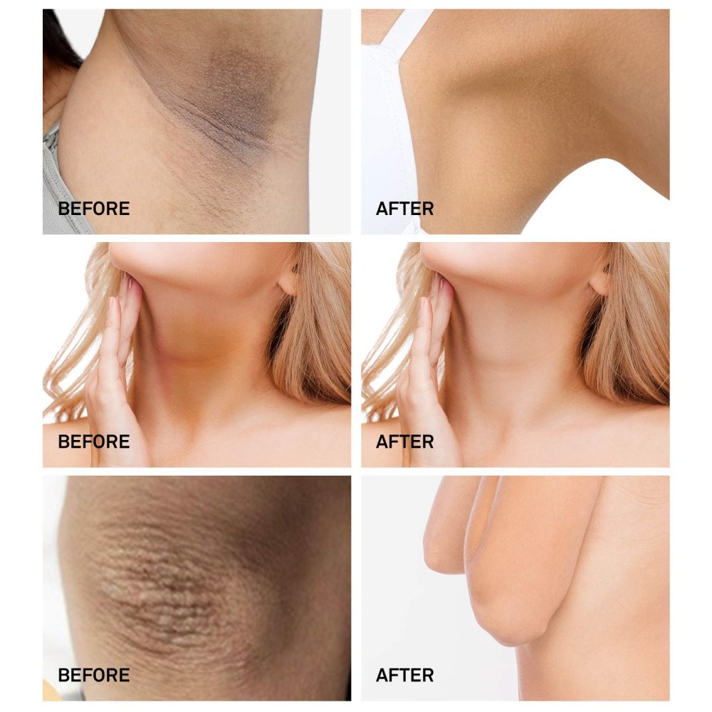 AsaVea Dark Spot Cream Natural Underarm Cream