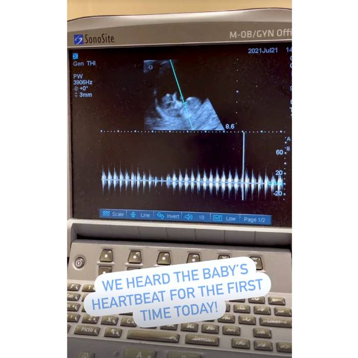 Pregnant Ashley Iaconetti Jared Haibon Show Ultrasound Video Ahead 1st Child