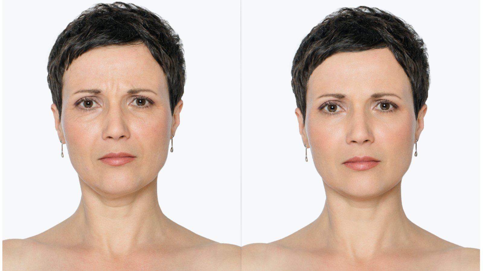 Before-After-Aging-Stock-Photo