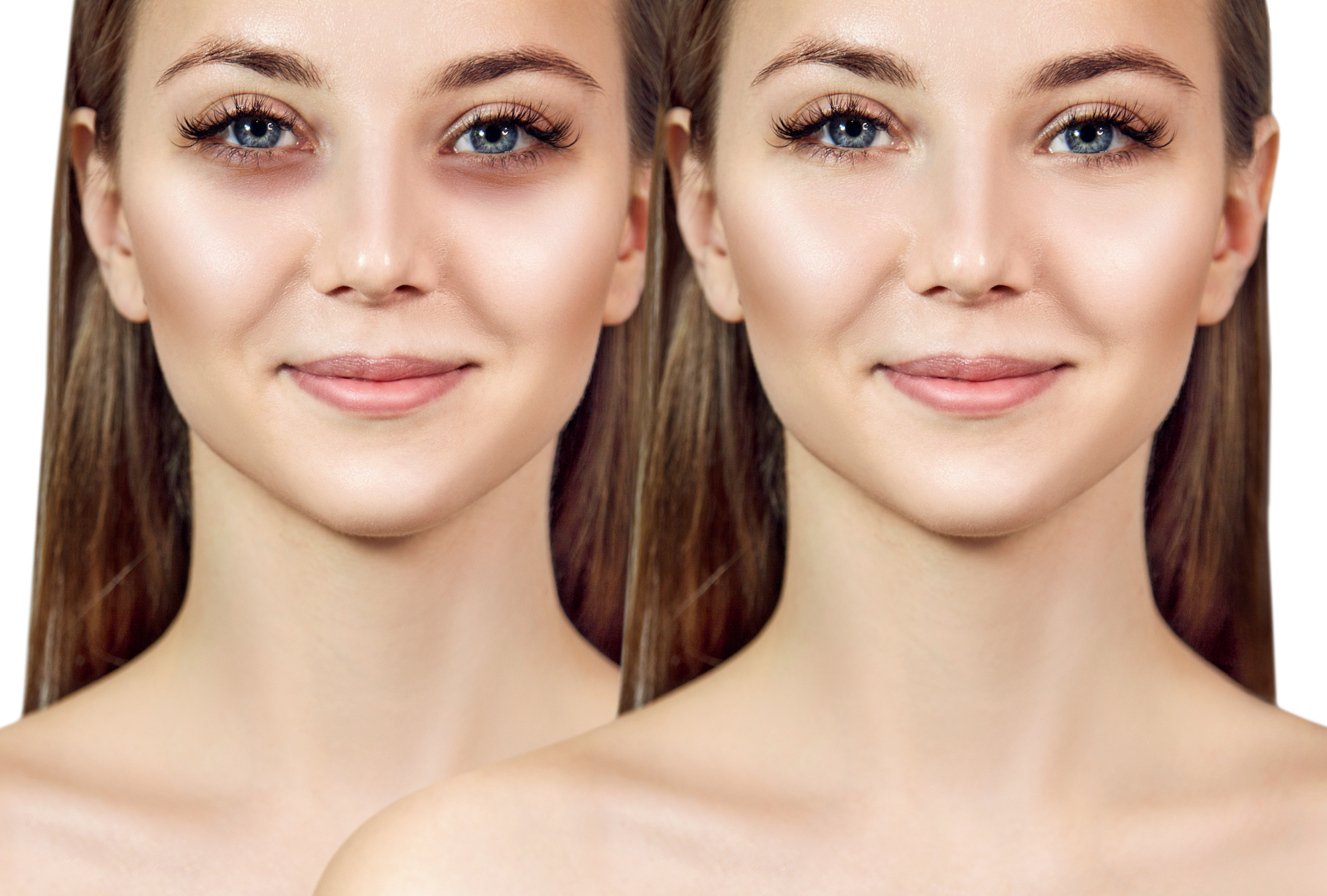 Actually, Using Baking Soda to Get Rid of Your Undereye Circles Is a  Terrible Idea