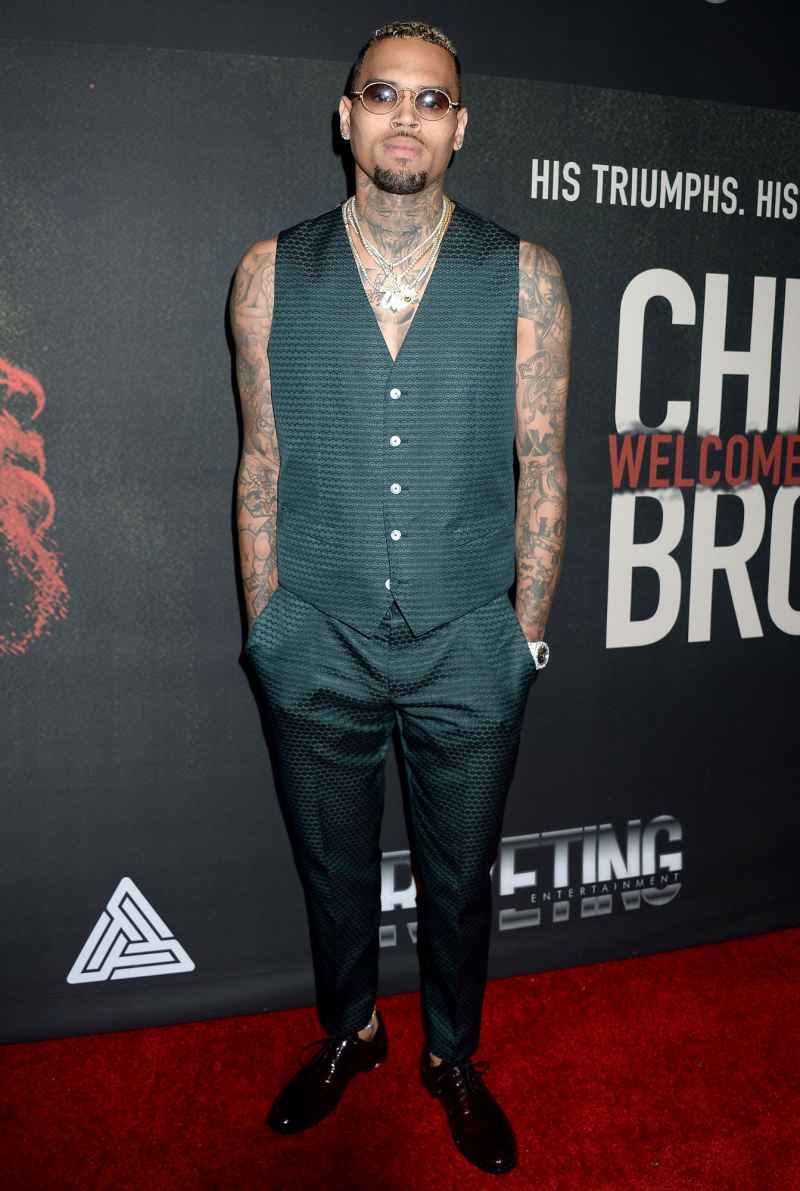 Chris Brown 24-Carat Gold Grill Magnetically Attaches to His Teeth