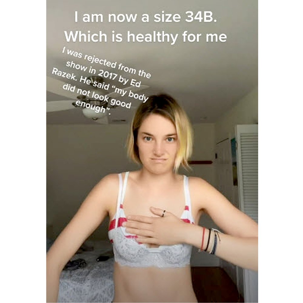 Former Victoria Secret Model Bridget Malcolm Slams Brand Joke Rebrand