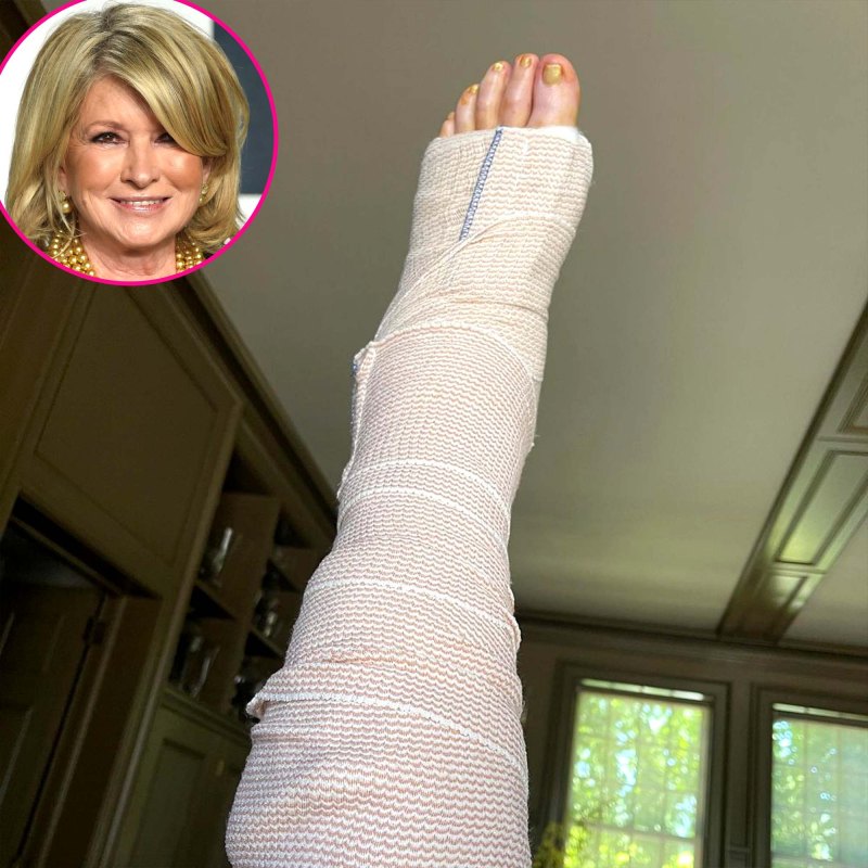 Martha Stewart Is Recuperating After 3 Hour Surgery