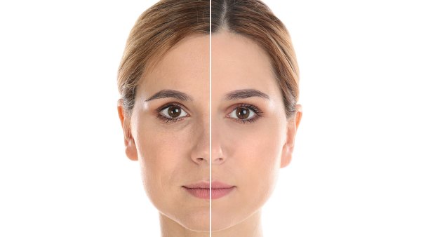 Reviewers-Say-This-Patent-Pending-Medical-Grade-Cryogenic-Stem-Cell-Cream-Making-Look-20-Again