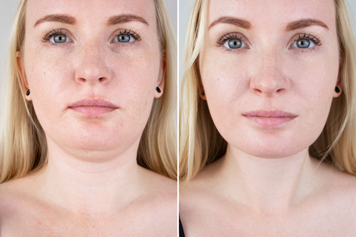 This-Retinol-Collagen-Lifting-Cream-Shows-Serious-Results-Just-15-Days