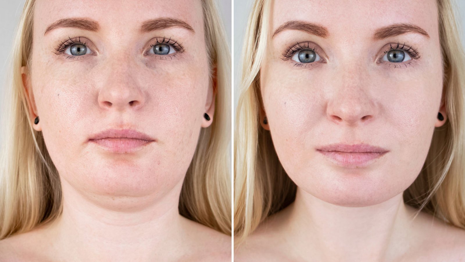 This-Retinol-Collagen-Lifting-Cream-Shows-Serious-Results-Just-15-Days