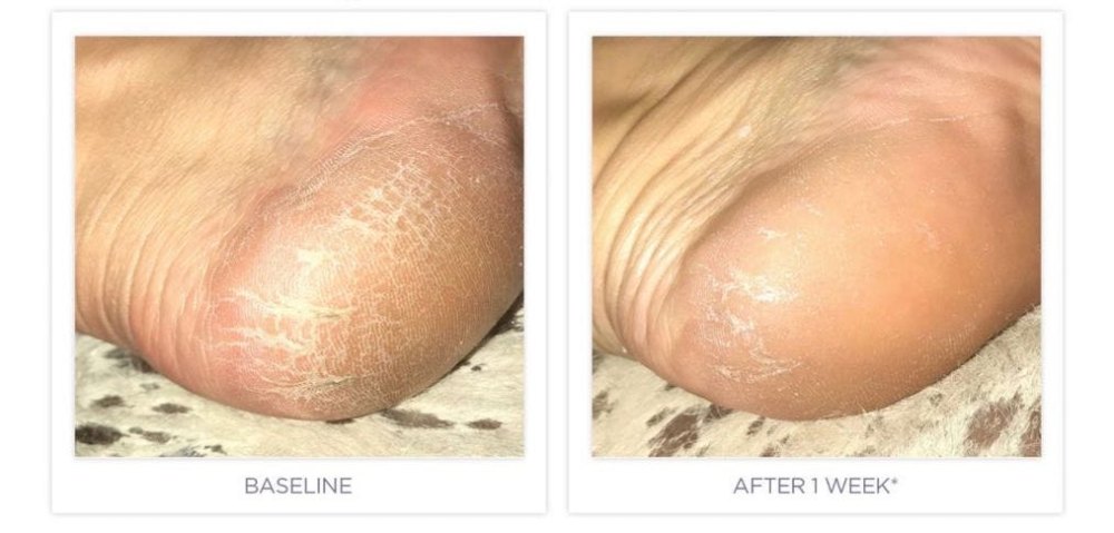 Ultra Softening Heel and Elbow Cream