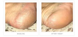 Ultra Softening Heel and Elbow Cream
