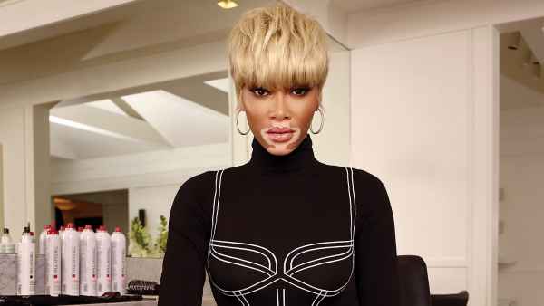 Winnie Harlow Is Obsessed With Wearing Wigs: ‘I’m Never Bored’