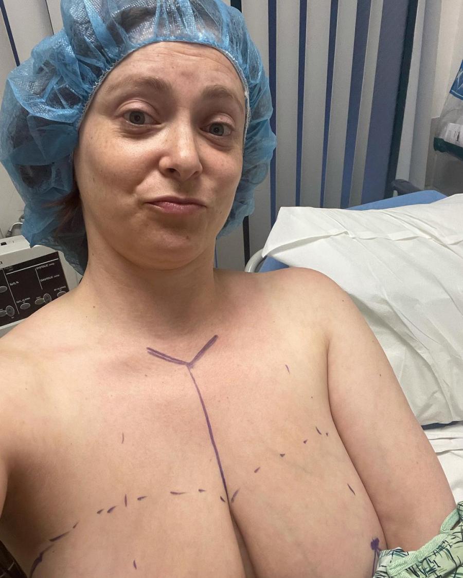 Actress Rachel Bloom Shares Before and After Photos From Breast Reduction Surgery