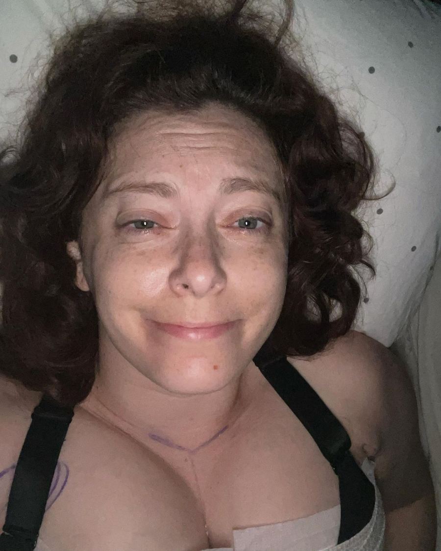 Actress Rachel Bloom Shares Before and After Photos From Breast Reduction Surgery