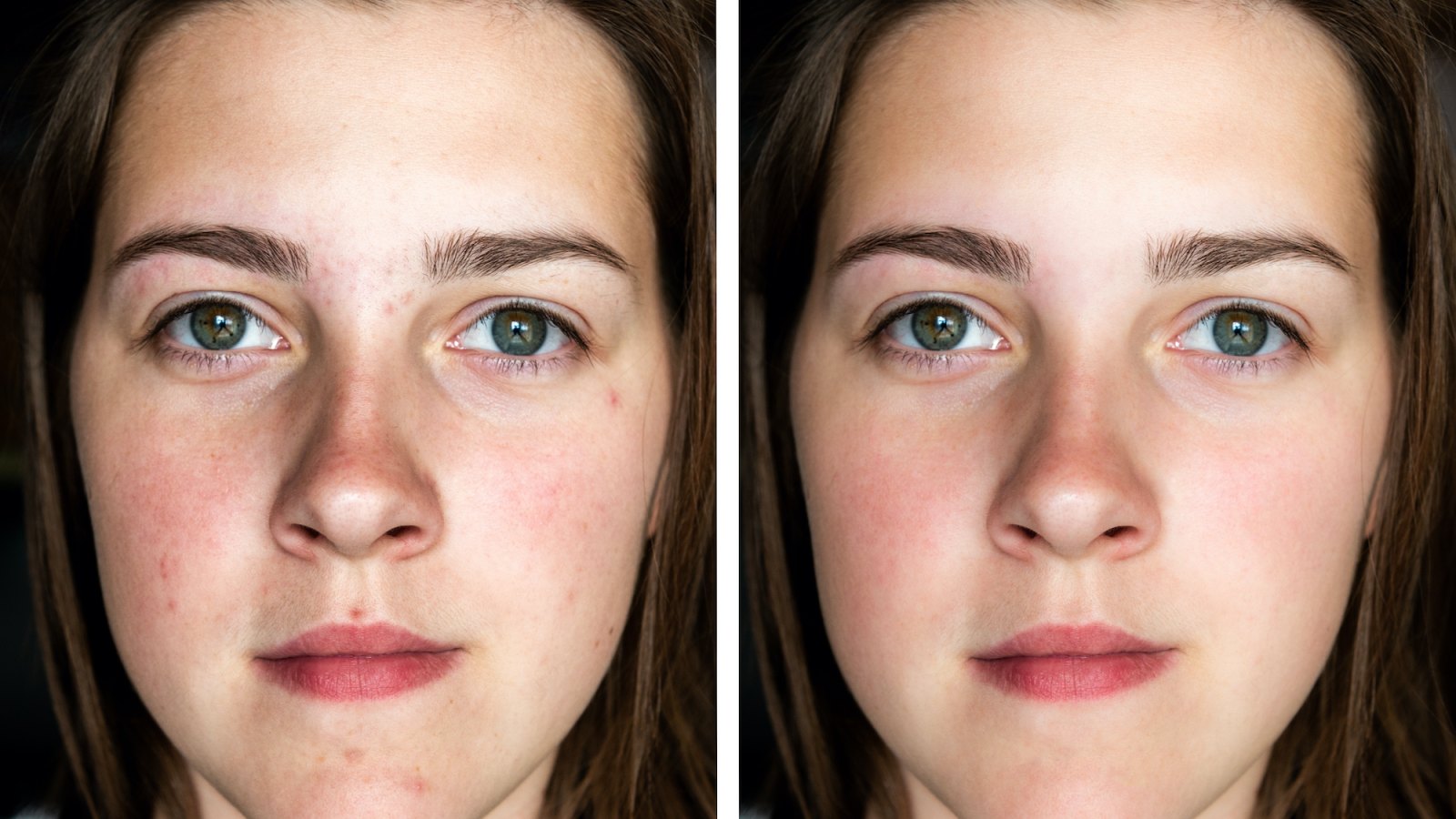 Before-After-Skincare