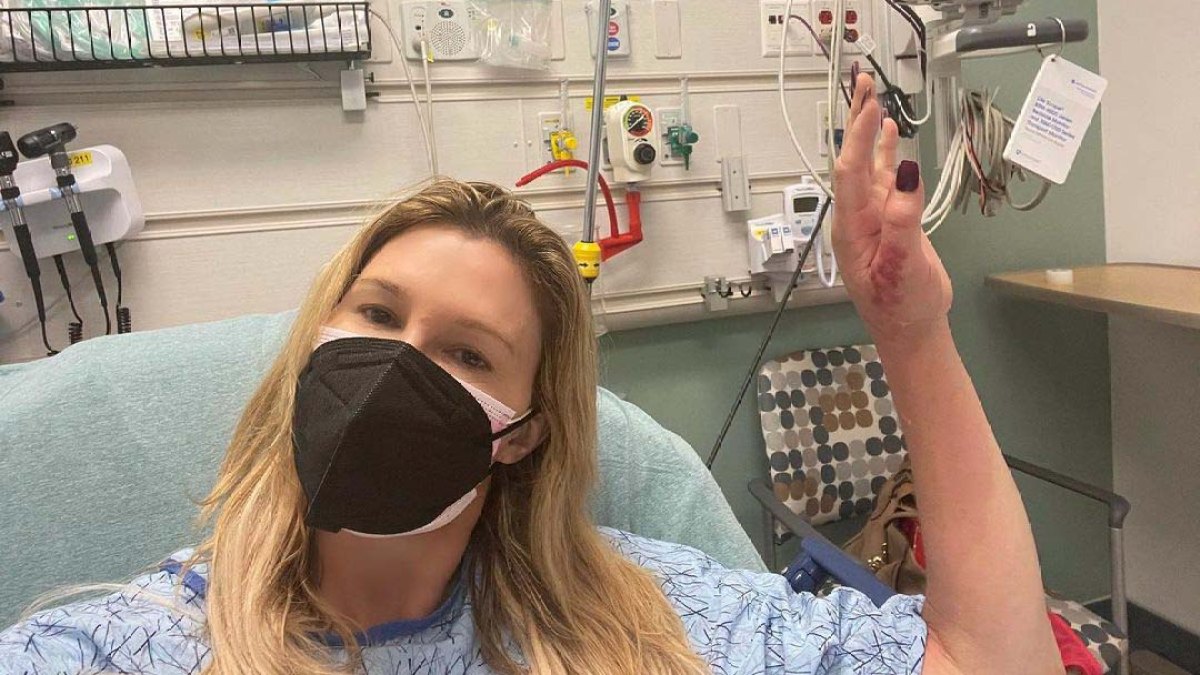 Brandi Glanville Hospitalized Hand Infection I Could Lose Limb