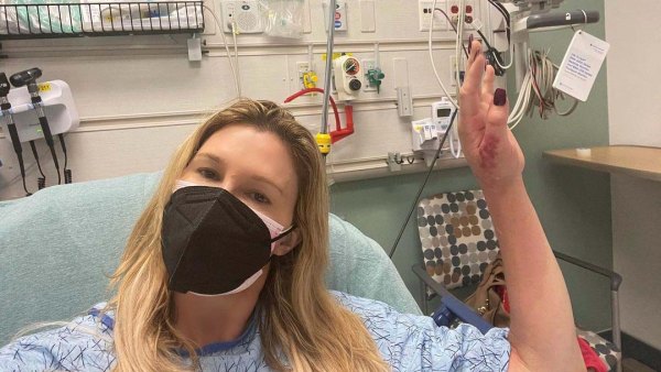 Brandi Glanville Hospitalized Hand Infection I Could Lose Limb