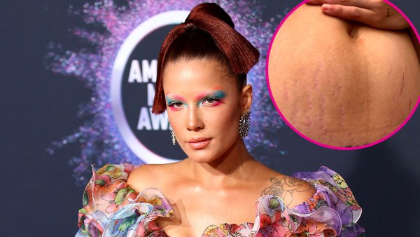 Halsey Shares Candid Snap of Postpartum Body: ‘This Is What It Look Like’