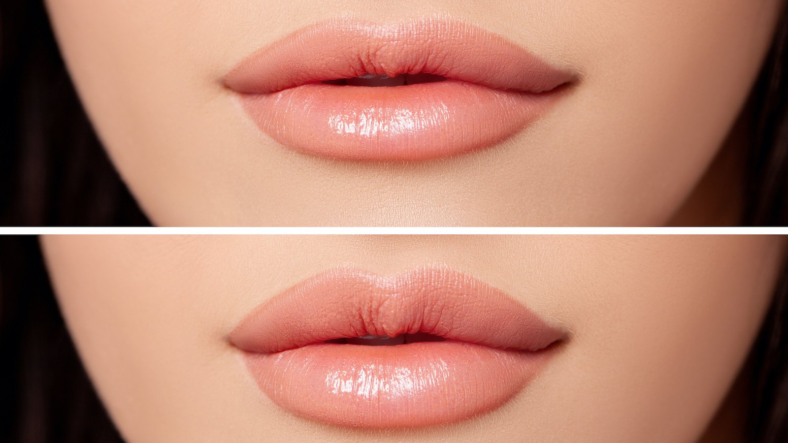 Lip-Treatment-Stock-Photo