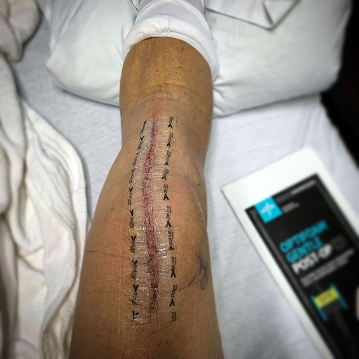 Ryan Sutter Reveals He Had Knee Replacement Surgery Amid Lyme Disease Battle