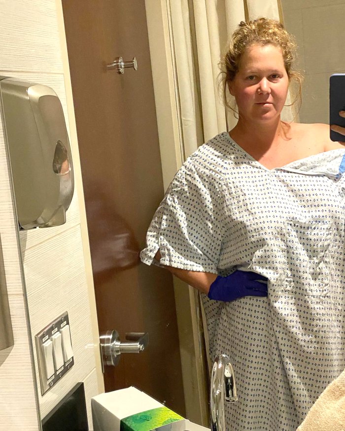 Amy Schumer detalla su intensa cirugía de endometriosis: 'El doctor encontró 30 manchas'