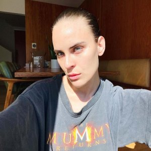 How Talulah Willis Went From Chronic Picker Having Supple Skin