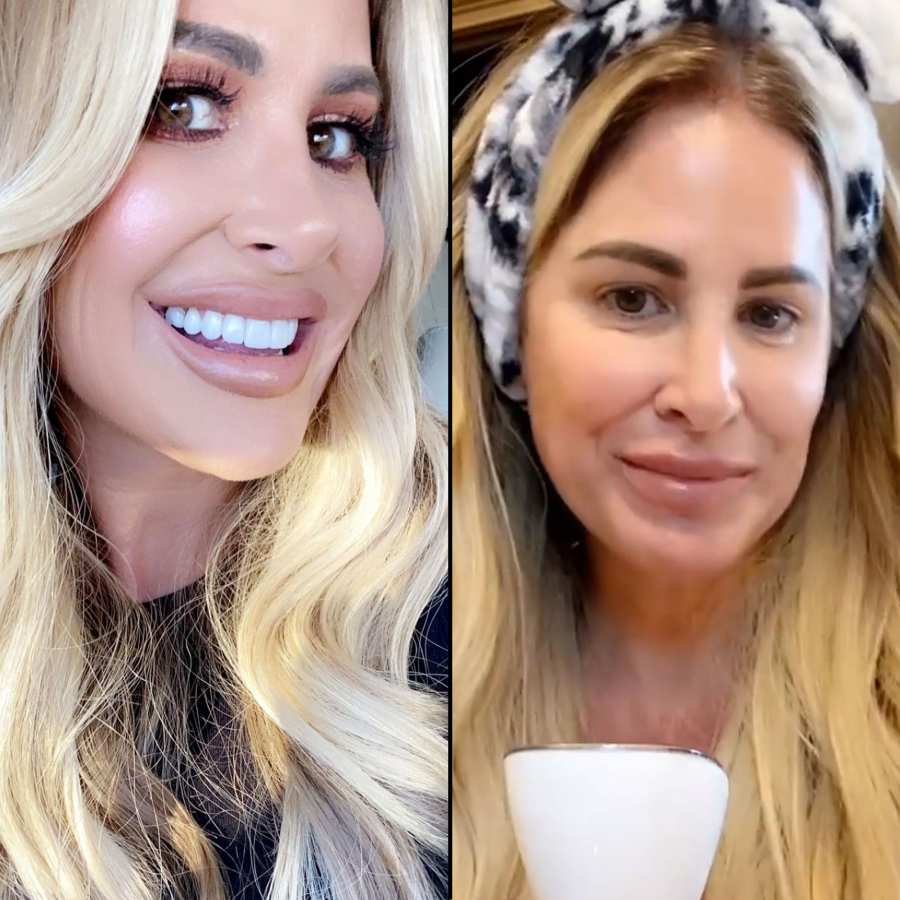 Kim Zolciak-Biermann Secret for Fighting Fine Lines